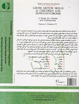 مهارت های حرکتی کودکان سندروم داون